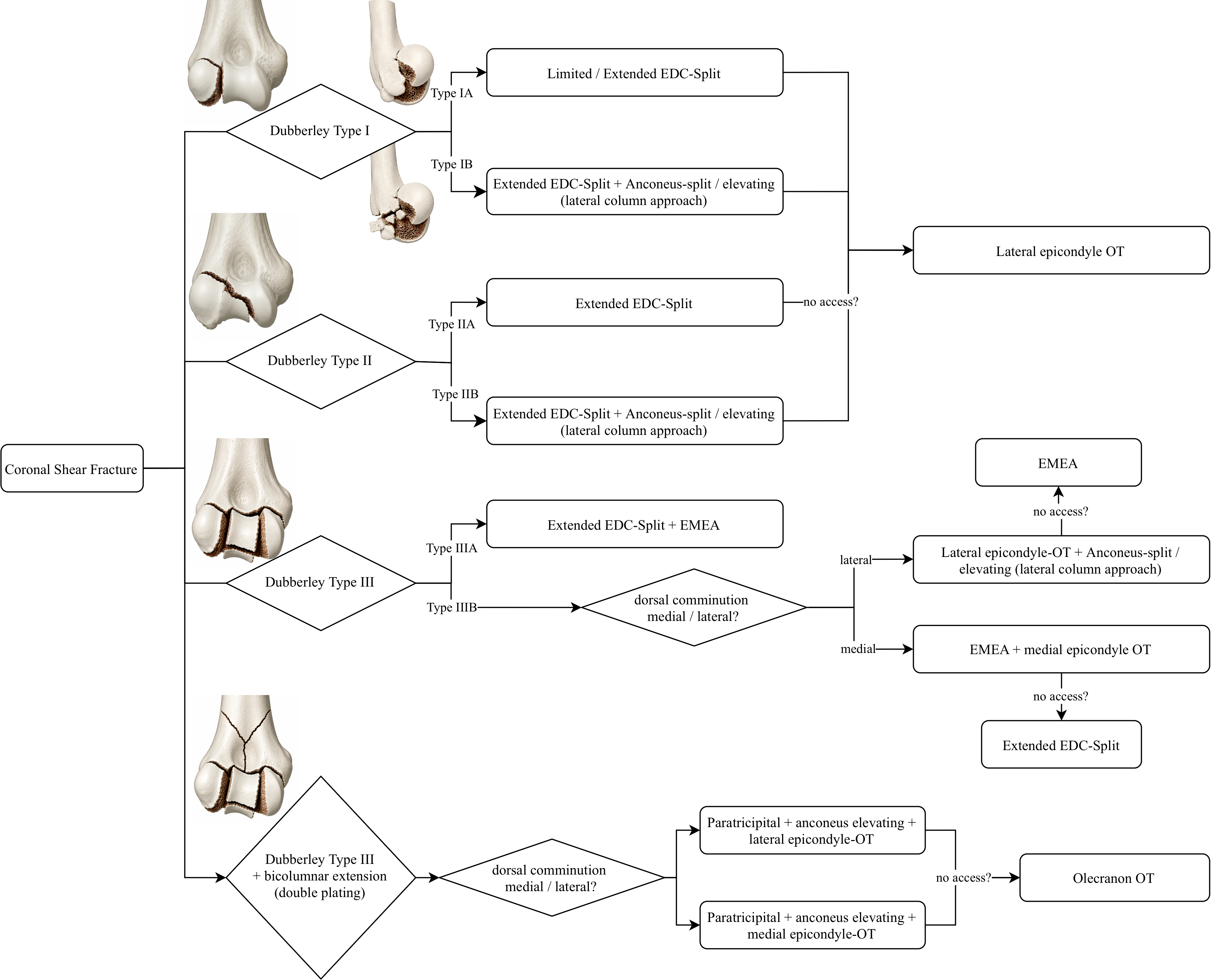 Original surgical algorithm